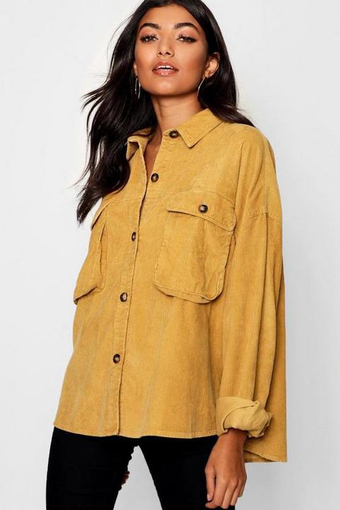 oversized yellow buttons